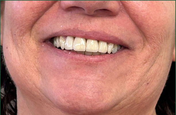 Cape Cod Dental | Dentures, Teeth Whitening and Cosmetic Dentistry