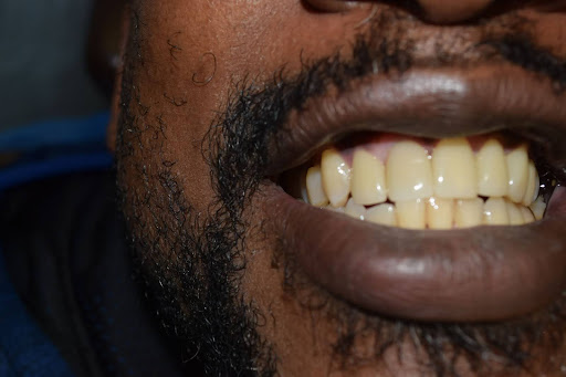 Cape Cod Dental | Intraoral Camera, Emergency Treatment and Dentures