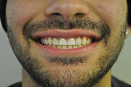 Cape Cod Dental | Dentures, Oral Exams and Preventative Program