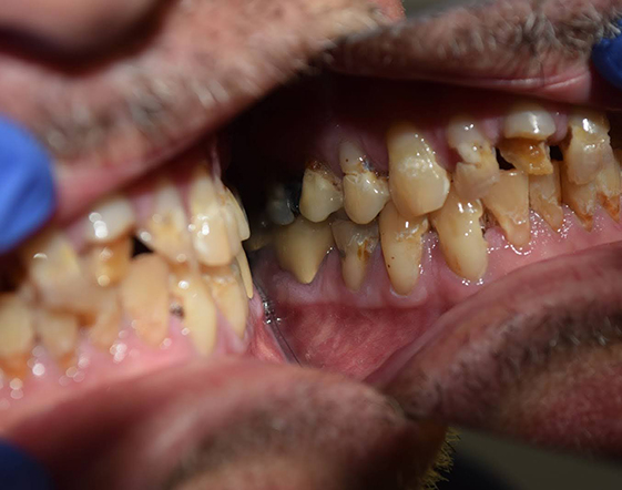 Cape Cod Dental | Oral Exams, Pediatric Dentistry and ZOOM  Whitening